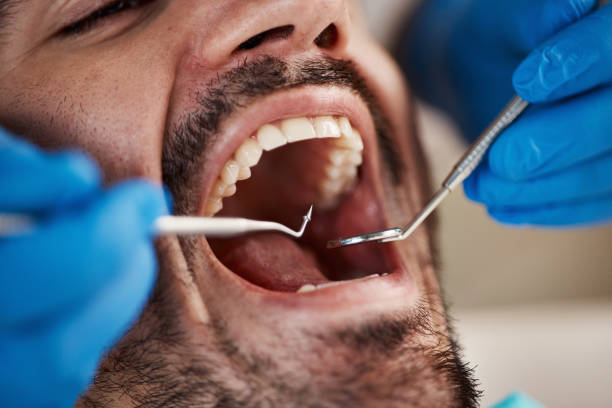 Best Emergency Dental Care for Broken or Chipped Teeth in Roosevelt Park, MI